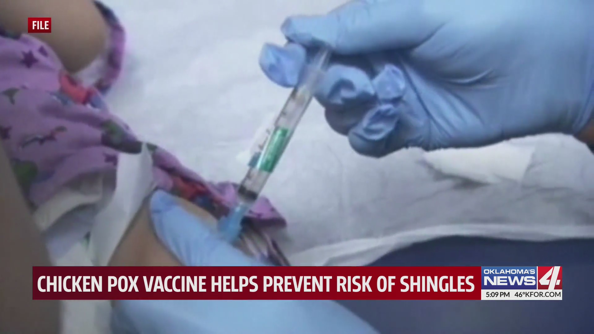 Chicken pox vaccine helps prevent risk of shingles – KFOR.com Oklahoma City