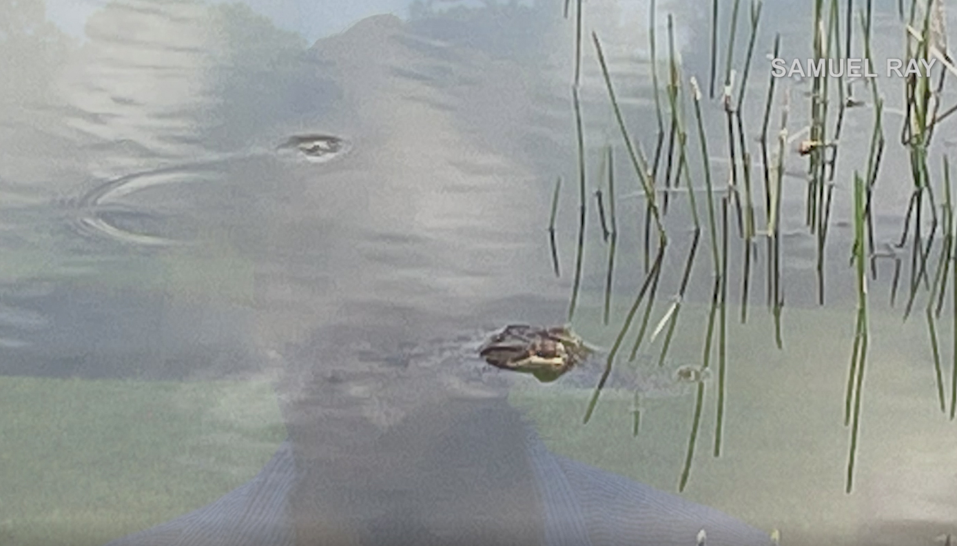 Lakewood Ranch man describes alligator attack WFLA