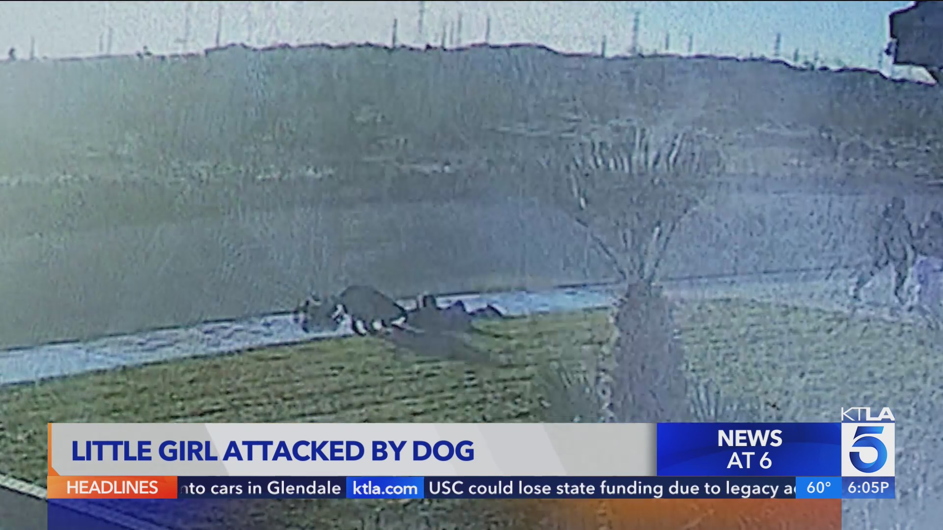 Little girl recovering after attack from stray dog – KTLA