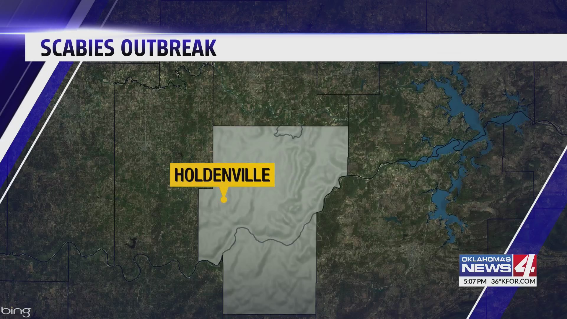 Holdenville school sees spike in scabies cases Oklahoma City