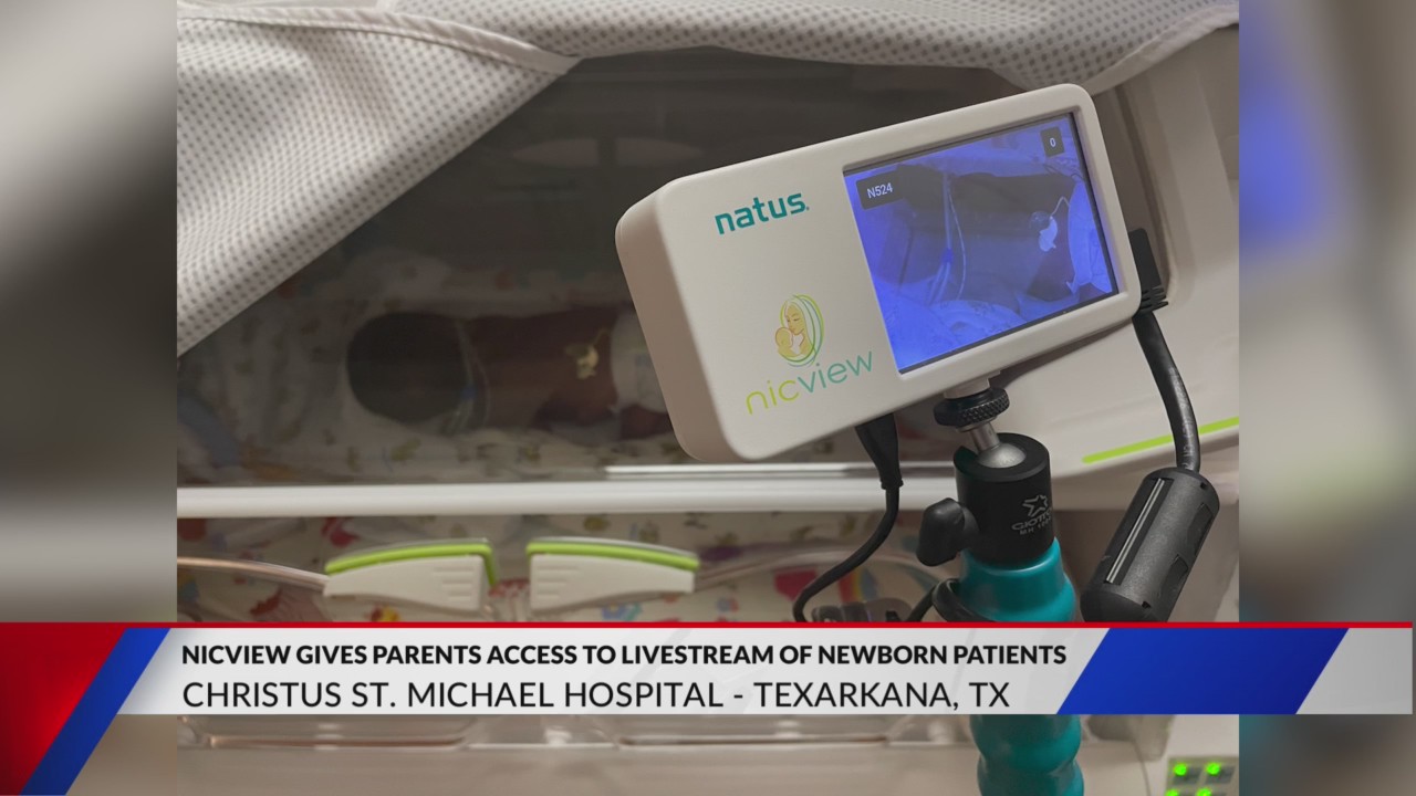 Nicview Images Christus St. Michael unveils new NICVIEW for the NICU – KTALnews.com