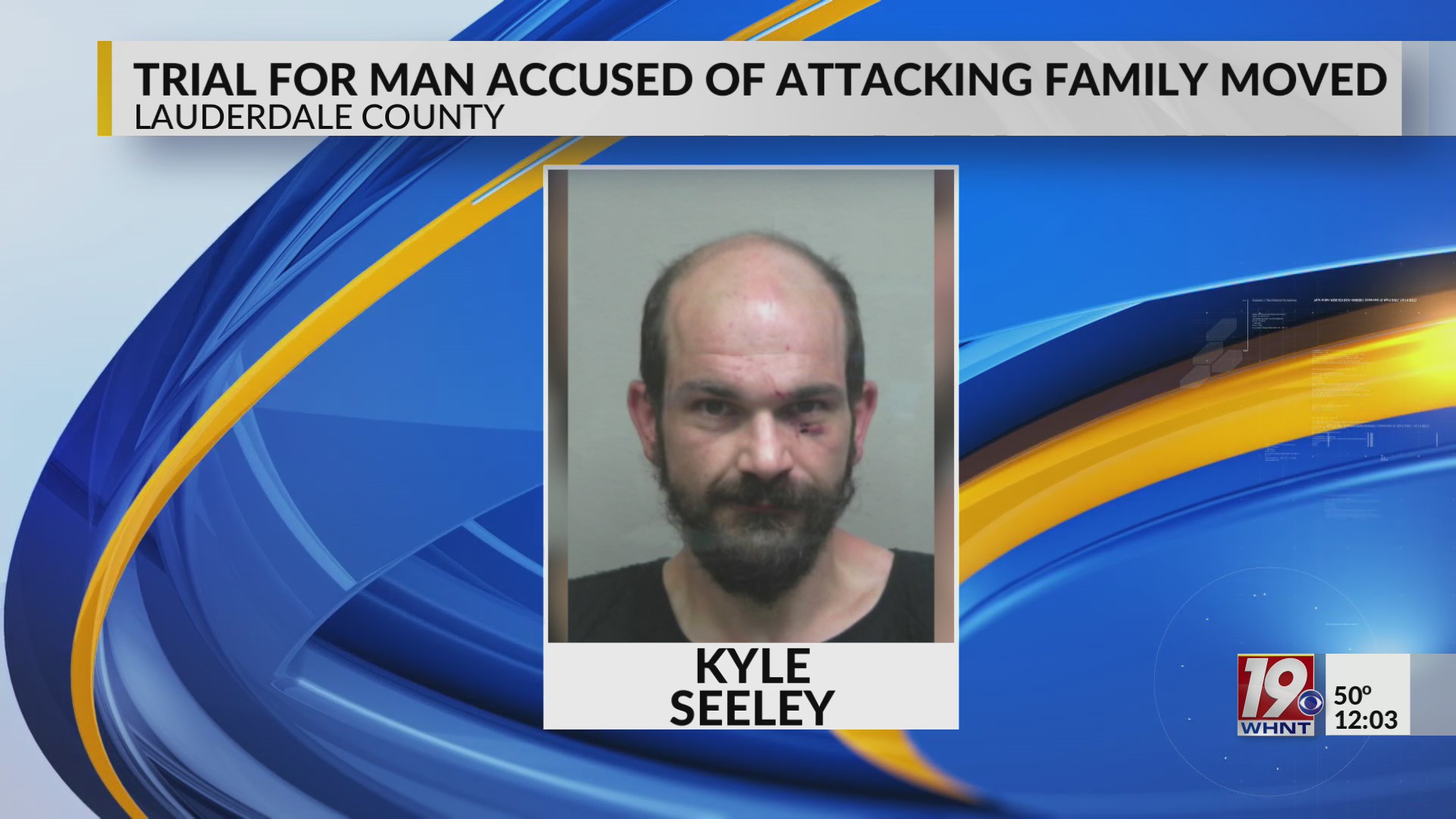 Broken Leg Causes Trial Delay for Machete Attack Suspect – WHNT.com