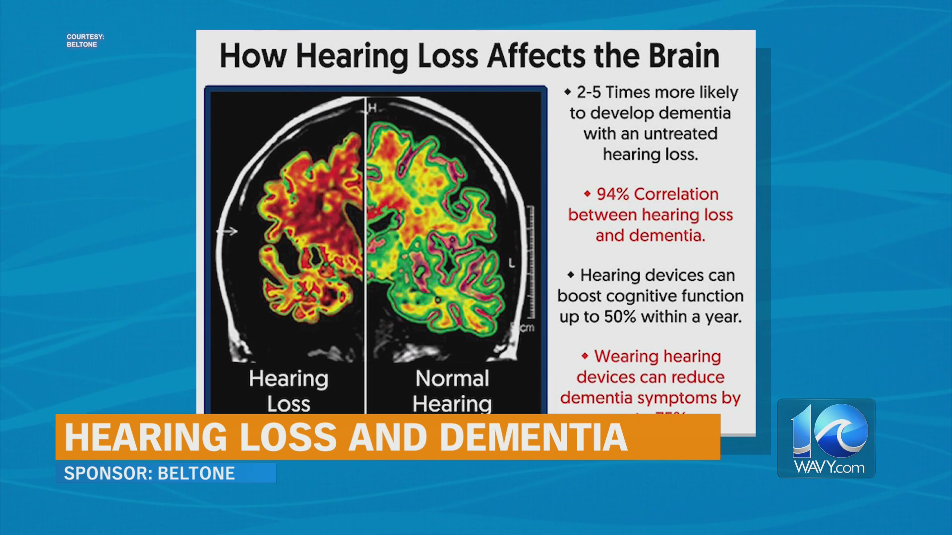 Hearing Loss and Dementia – WAVY.com