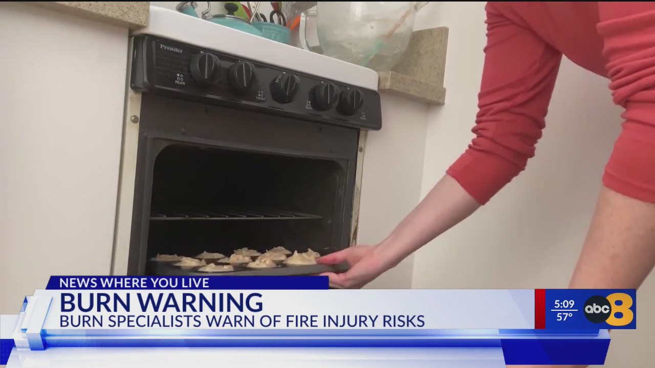 ‘It was very, very painful’ VCU burn doctors warn about scald injuries