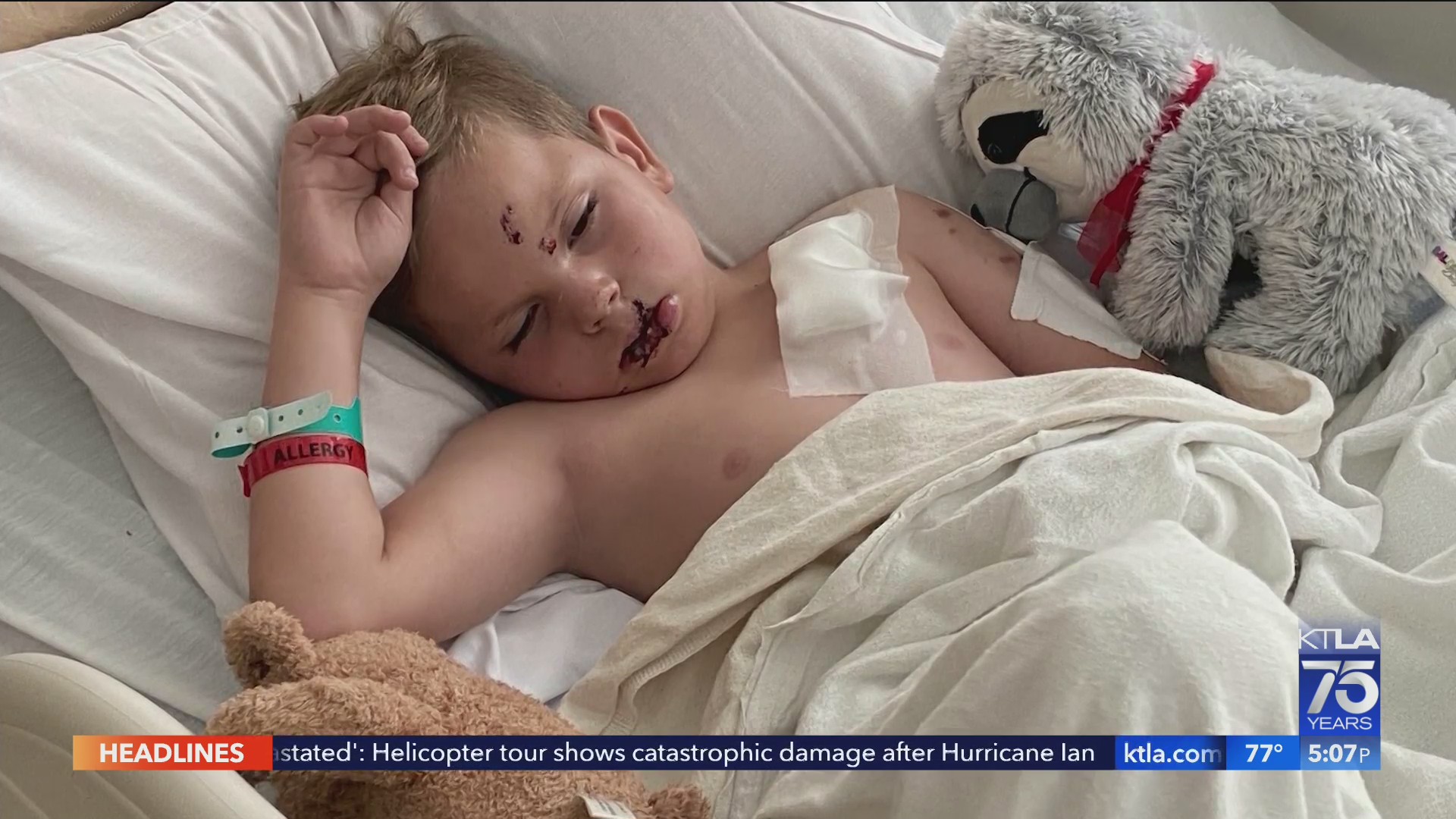 8-year-old boy attacked by dog at daycare center – KTLA