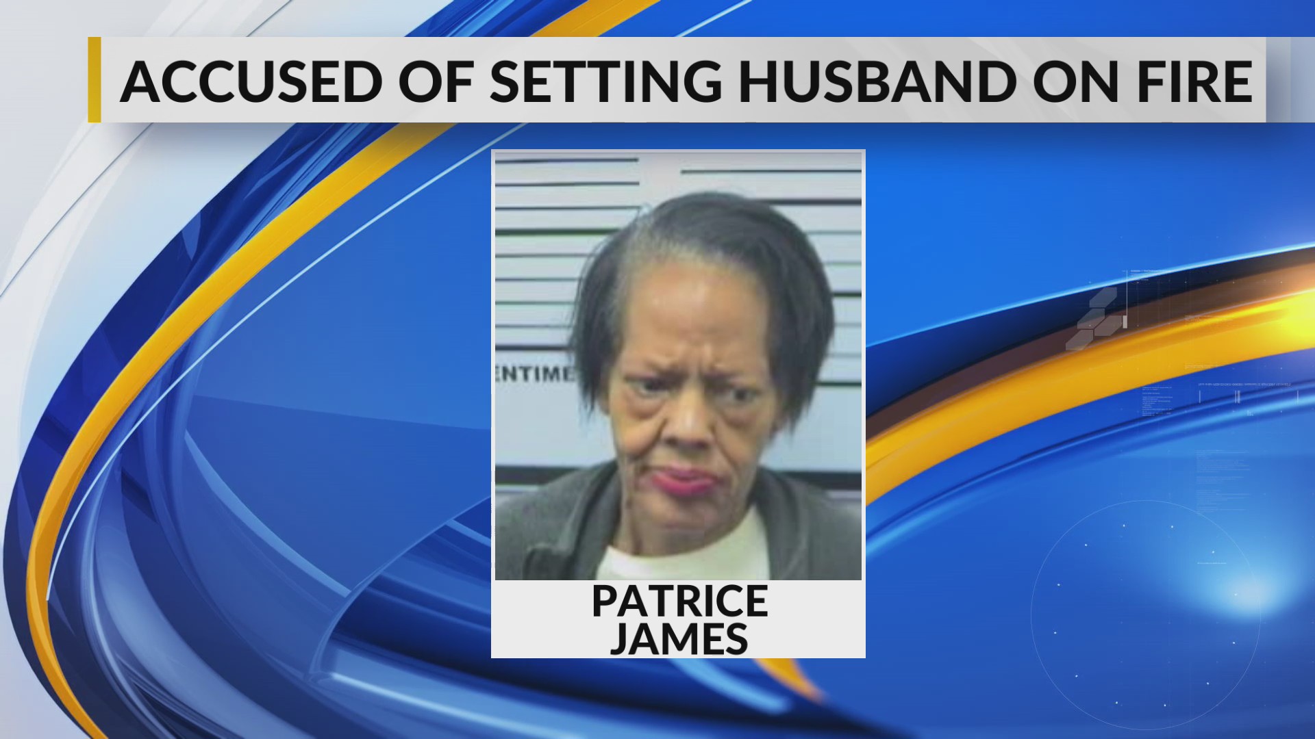 Husband suffers life-threatening injuries after wife allegedly sets him ...