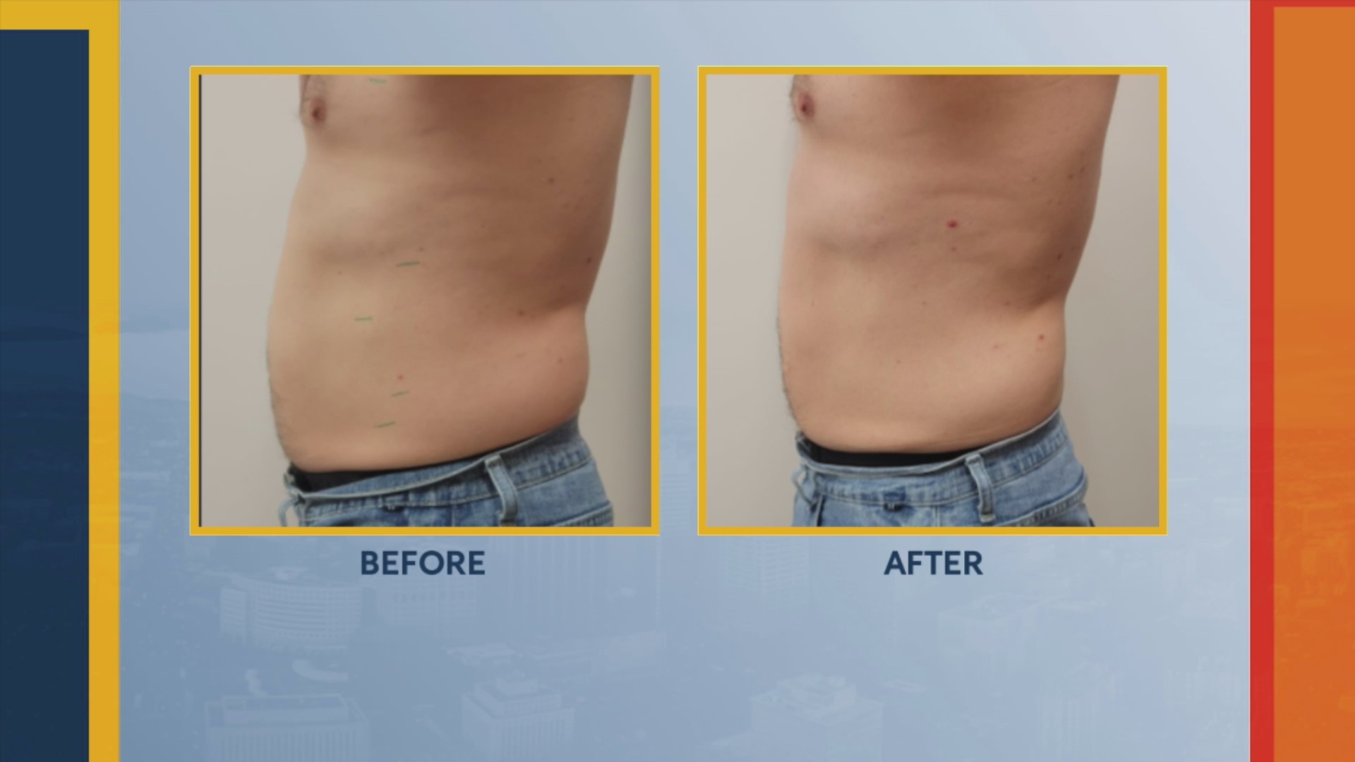 Absolute Beauty Solutions FOX31 Denver