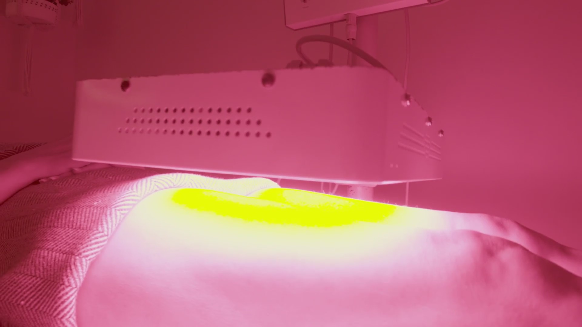 Absolute Beauty Solutions FOX31 Denver