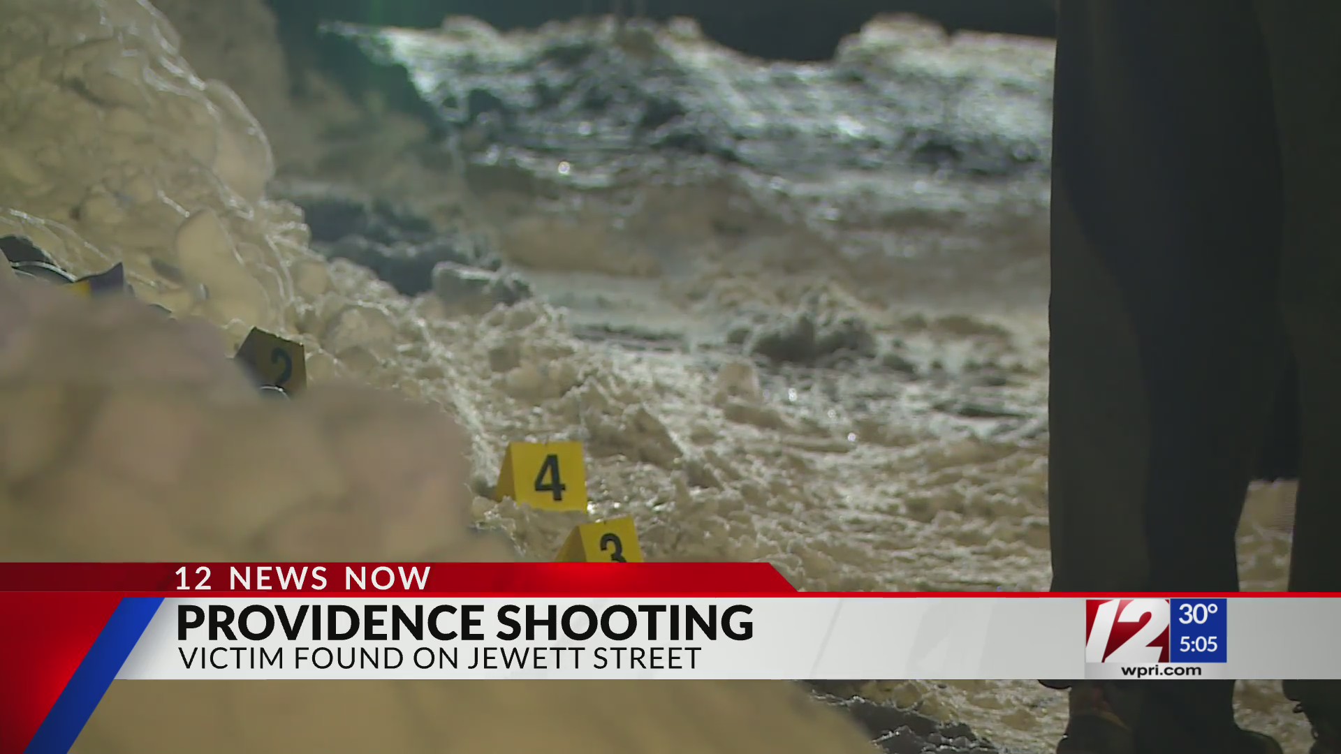 Man’s head grazed by bullet in Providence – WPRI.com