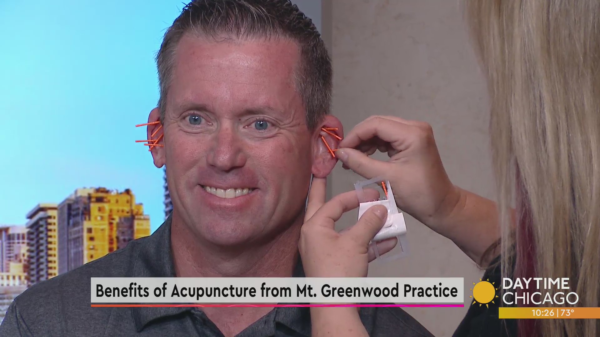 Benefits of Acupuncture from Mt. Greenwood Practice WGNTV