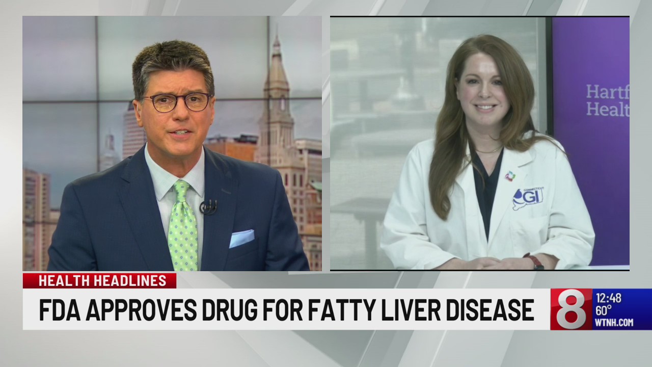 New drug to treat fatty liver disease clears the FDA: Hartford ...