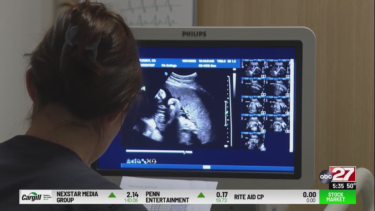PA College of Health Sciences offering free ultrasounds