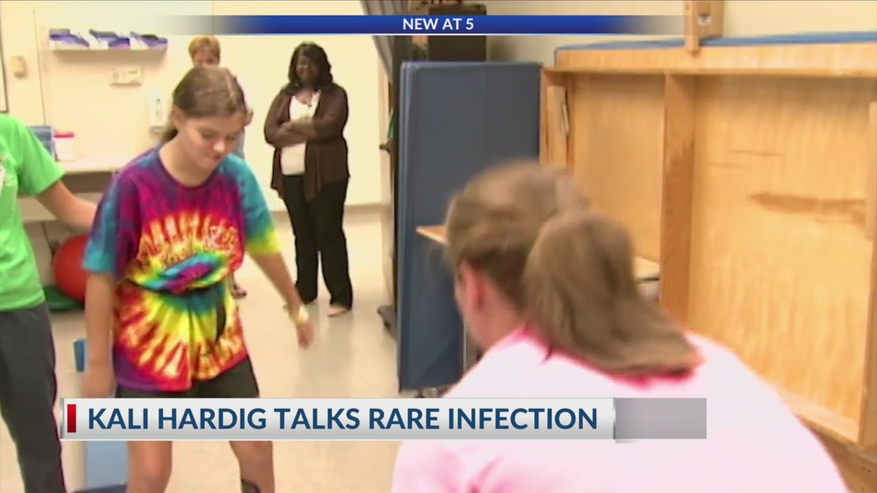 Arkansan Kali Hardig shares story of surviving braineating amoeba 10