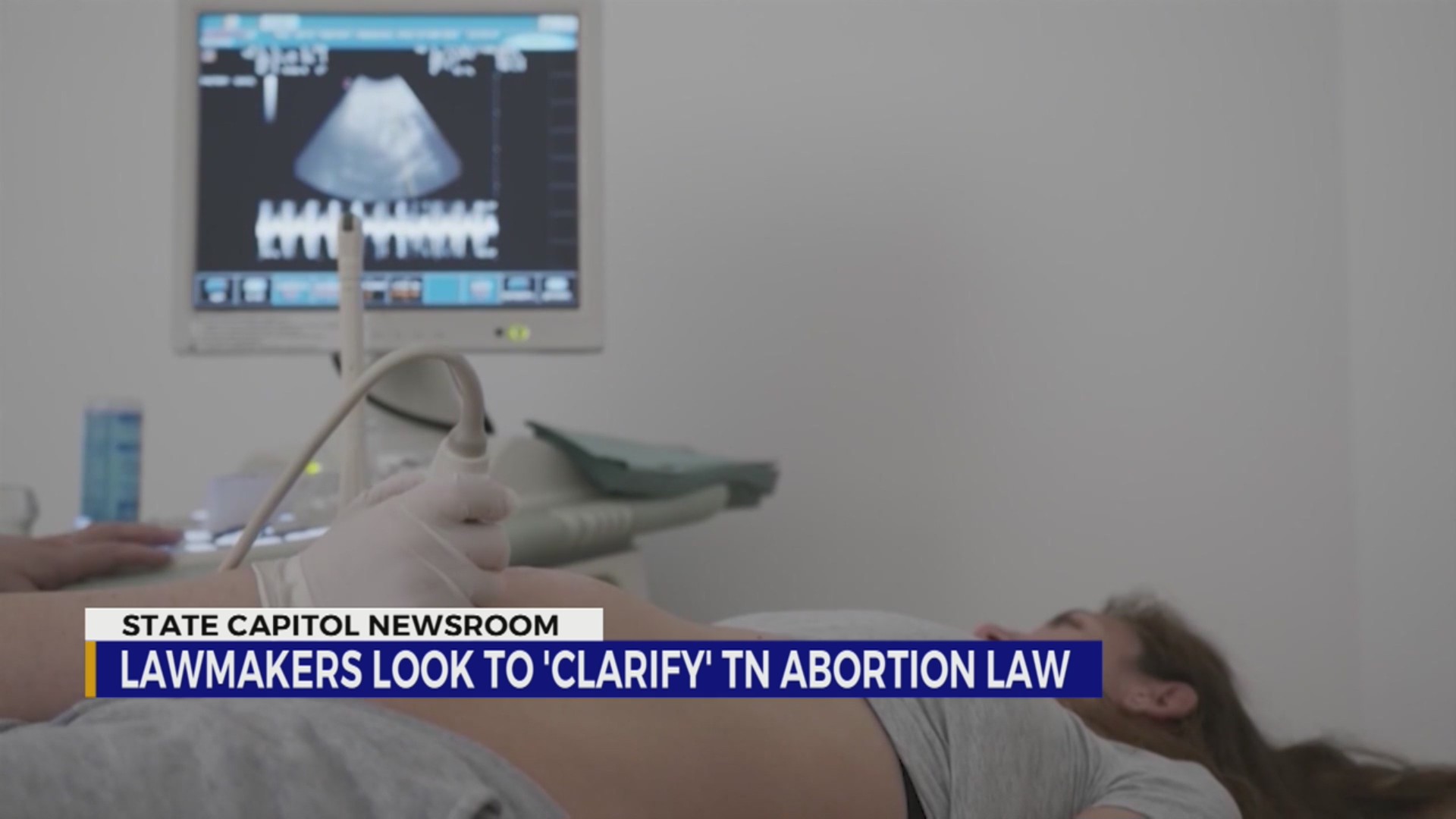 Senator plans to file bill adding exceptions to Tennessee abortion law