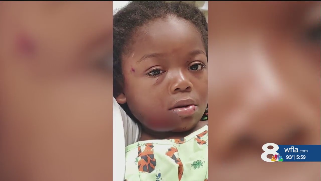 ‘I heard screaming’: 4-year-old boy attacked by dog in Lakewood Ranch ...