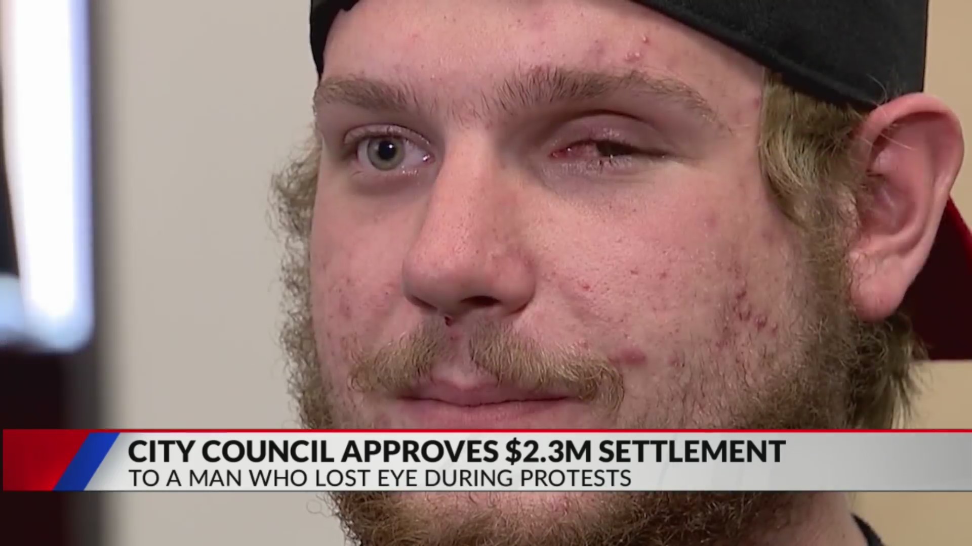 Denver council approves $2.3M settlement for protester who lost eye ...