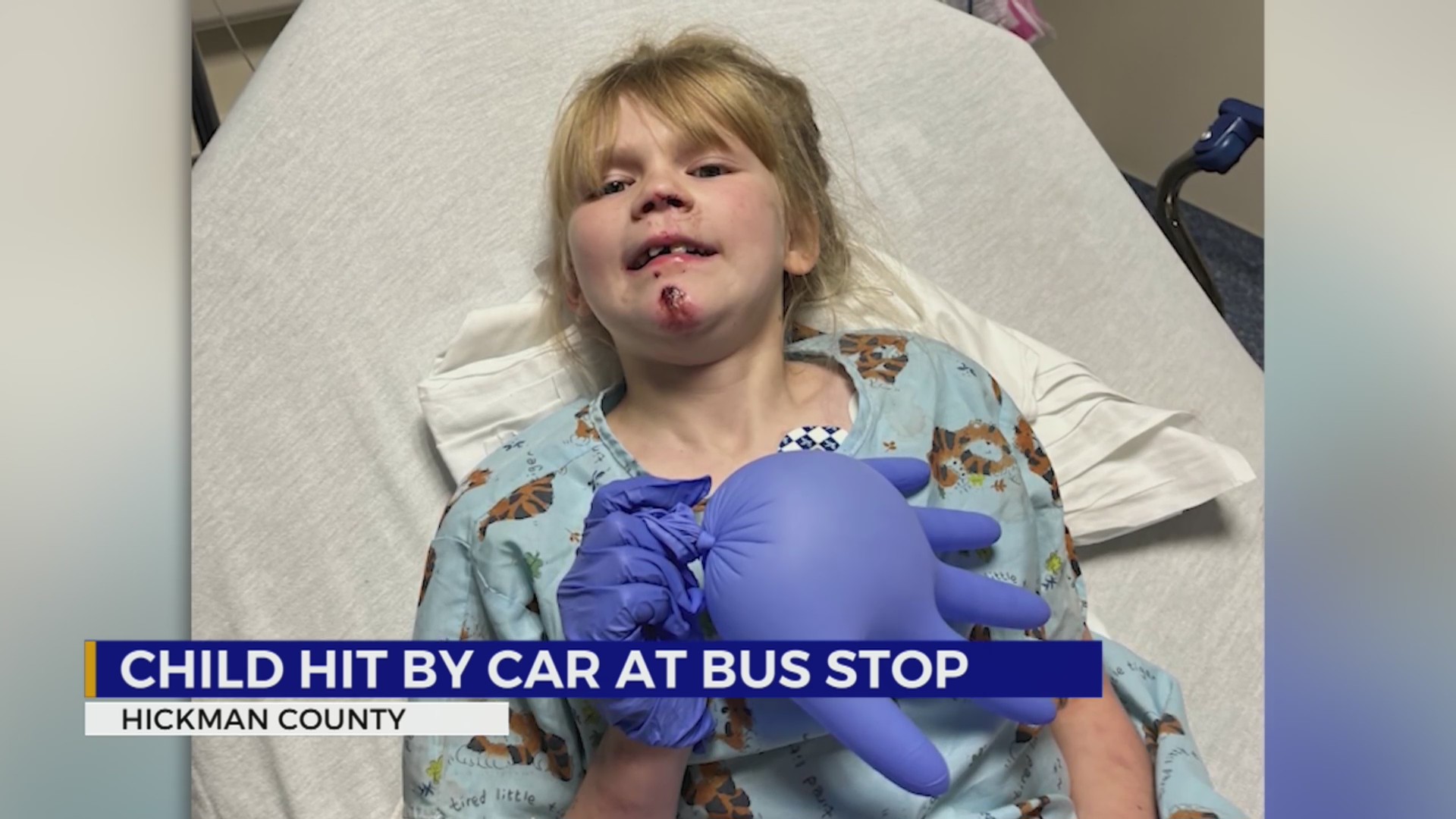 Child hit by car at Tennessee bus stop – WKRN News 2