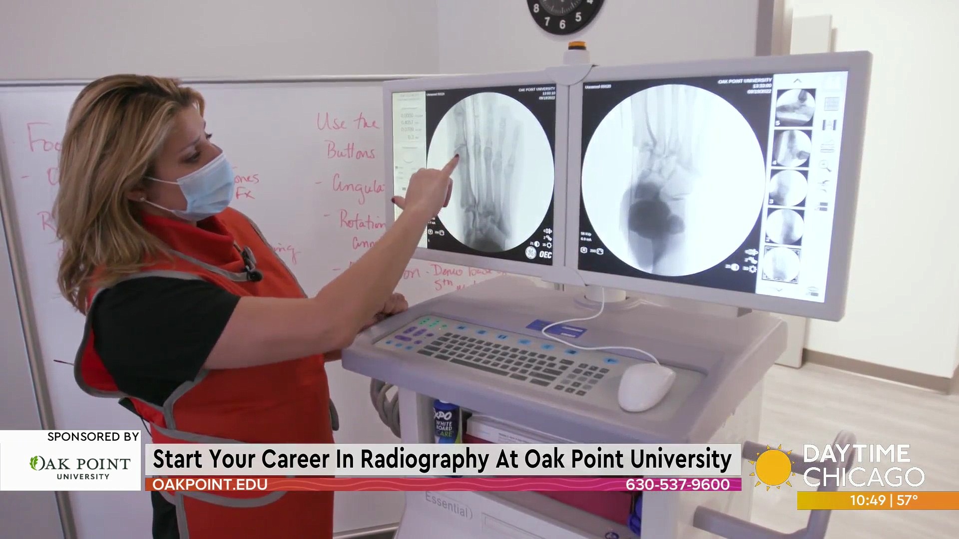 Start Your Career In Radiography At Oak Point University Wgn Tv Start Your Career In Radiography At Oak Point University Wgn Tv