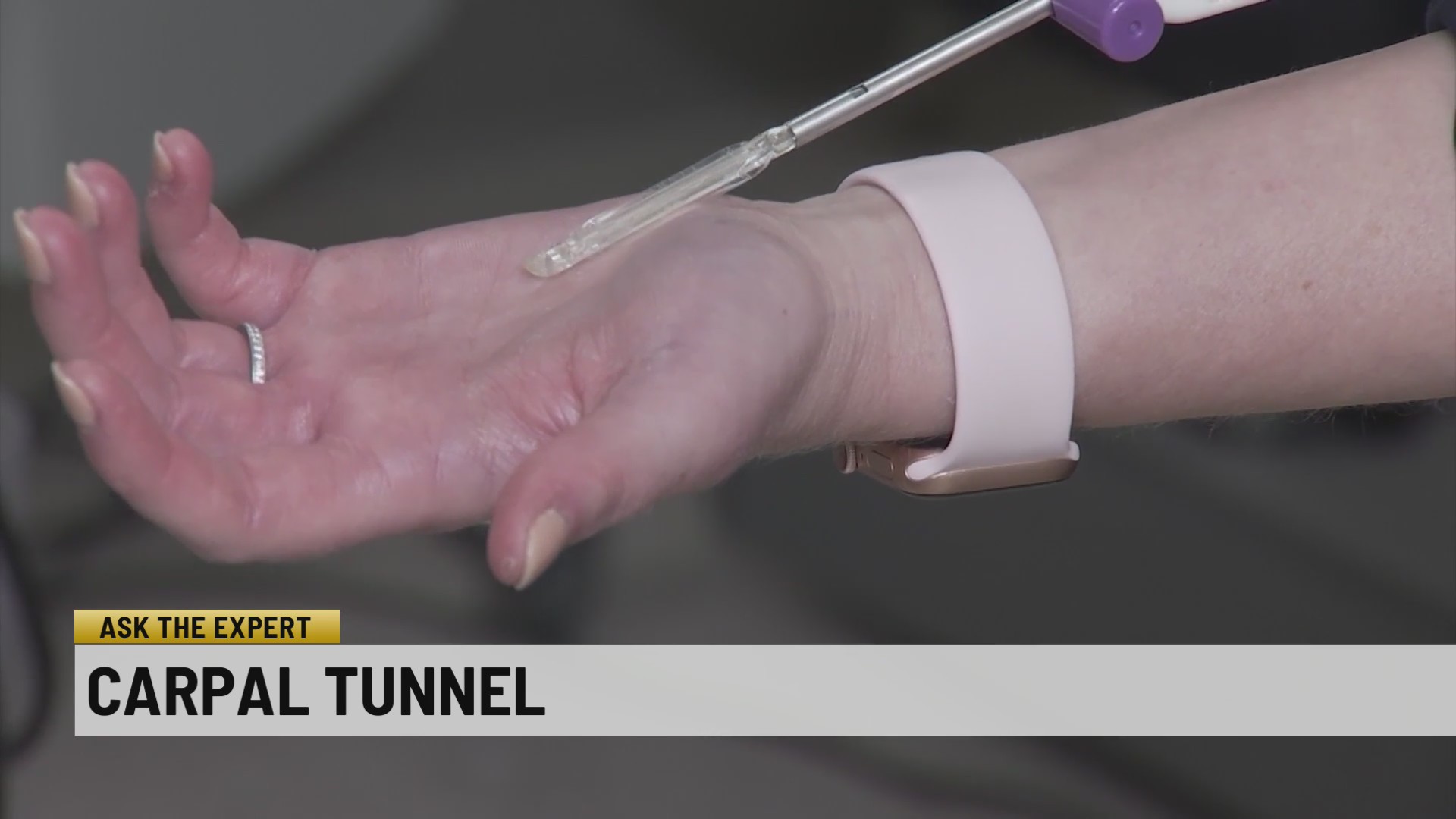New surgery technique for carpal tunnel WSPA 7NEWS